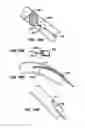 Fig. 40 - ENDOLUMINAL FILTER WITH FIXATION