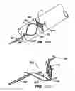 Fig. 67 - ENDOLUMINAL FILTER WITH FIXATION