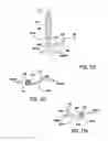 Fig. 72 - ENDOLUMINAL FILTER WITH FIXATION