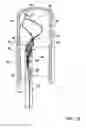 Fig. 76 - ENDOLUMINAL FILTER WITH FIXATION