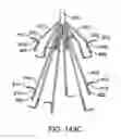 Fig. 82 - ENDOLUMINAL FILTER WITH FIXATION