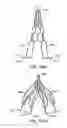 Fig. 83 - ENDOLUMINAL FILTER WITH FIXATION