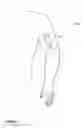 Fig. 02 - MULTI-MODE INFLATABLE LIMB OCCLUSION DEVICE