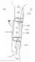 Fig. 01 - CLIP-BASED SYSTEMS AND METHODS FOR TREATING SEPTAL DEFECTS
