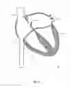 Fig. 04 - EXPANDABLE OCCLUSION DEVICE AND METHODS