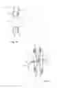 Fig. 11 - EXPANDABLE OCCLUSION DEVICE AND METHODS