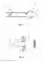 Fig. 16 - EXPANDABLE OCCLUSION DEVICE AND METHODS