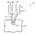Fig. 01 - Soft tissue fixation using a looped suture construct