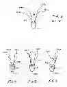 Fig. 09 - Soft tissue fixation using a looped suture construct