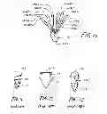 Fig. 10 - Soft tissue fixation using a looped suture construct