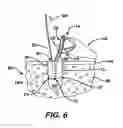 Fig. 06 - Adjustable anchor systems and methods