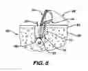 Fig. 08 - Adjustable anchor systems and methods