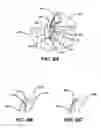 Fig. 09 - Adjustable anchor systems and methods