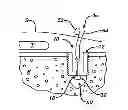 Fig. 01 - Surgical filament snare assemblies