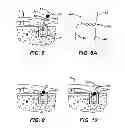 Fig. 04 - Surgical filament snare assemblies