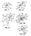 Fig. 05 - Surgical filament snare assemblies