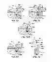 Fig. 06 - Surgical filament snare assemblies