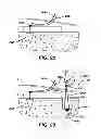 Fig. 08 - Surgical filament snare assemblies