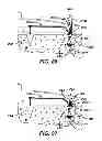 Fig. 10 - Surgical filament snare assemblies