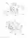 Fig. 07 - Expansion interspinous fixation device and method