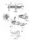 Fig. 22 - Flexible spine stabilization system