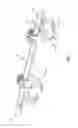 Fig. 02 - SPINAL CORRECTION SYSTEM