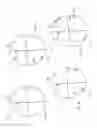 Fig. 02 - Leadless cardiac stimulation device employing distributed logic