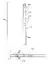 Fig. 01 - Electrically identifiable electrode lead and method of electrically identifying an electrode lead