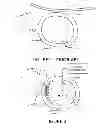 Fig. 02 - Transvascular nerve stimulation apparatus and methods