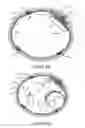 Fig. 06 - Transvascular nerve stimulation apparatus and methods