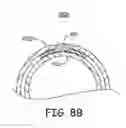 Fig. 09 - Medical electrical lead