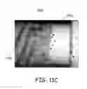 Fig. 13 - Medical electrical lead