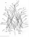 Fig. 01 - Endoprosthesis for implantation in the heart of a patient