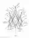 Fig. 03 - Endoprosthesis for implantation in the heart of a patient
