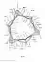 Fig. 04 - Endoprosthesis for implantation in the heart of a patient
