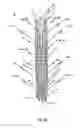 Fig. 07 - Endoprosthesis for implantation in the heart of a patient