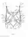 Fig. 09 - Endoprosthesis for implantation in the heart of a patient
