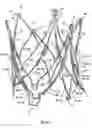 Fig. 15 - Endoprosthesis for implantation in the heart of a patient