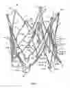 Fig. 20 - Endoprosthesis for implantation in the heart of a patient
