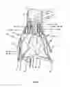 Fig. 22 - Endoprosthesis for implantation in the heart of a patient