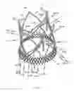 Fig. 29 - Endoprosthesis for implantation in the heart of a patient