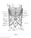 Fig. 34 - Endoprosthesis for implantation in the heart of a patient