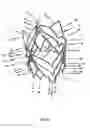 Fig. 40 - Endoprosthesis for implantation in the heart of a patient