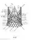 Fig. 45 - Endoprosthesis for implantation in the heart of a patient