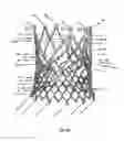Fig. 47 - Endoprosthesis for implantation in the heart of a patient