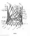 Fig. 53 - Endoprosthesis for implantation in the heart of a patient
