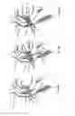 Fig. 56 - Endoprosthesis for implantation in the heart of a patient