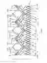 Fig. 63 - Endoprosthesis for implantation in the heart of a patient