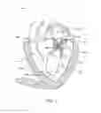 Fig. 02 - Methods and apparatus for delivering a prosthetic valve to a beating heart