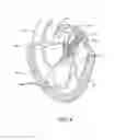 Fig. 06 - Methods and apparatus for delivering a prosthetic valve to a beating heart